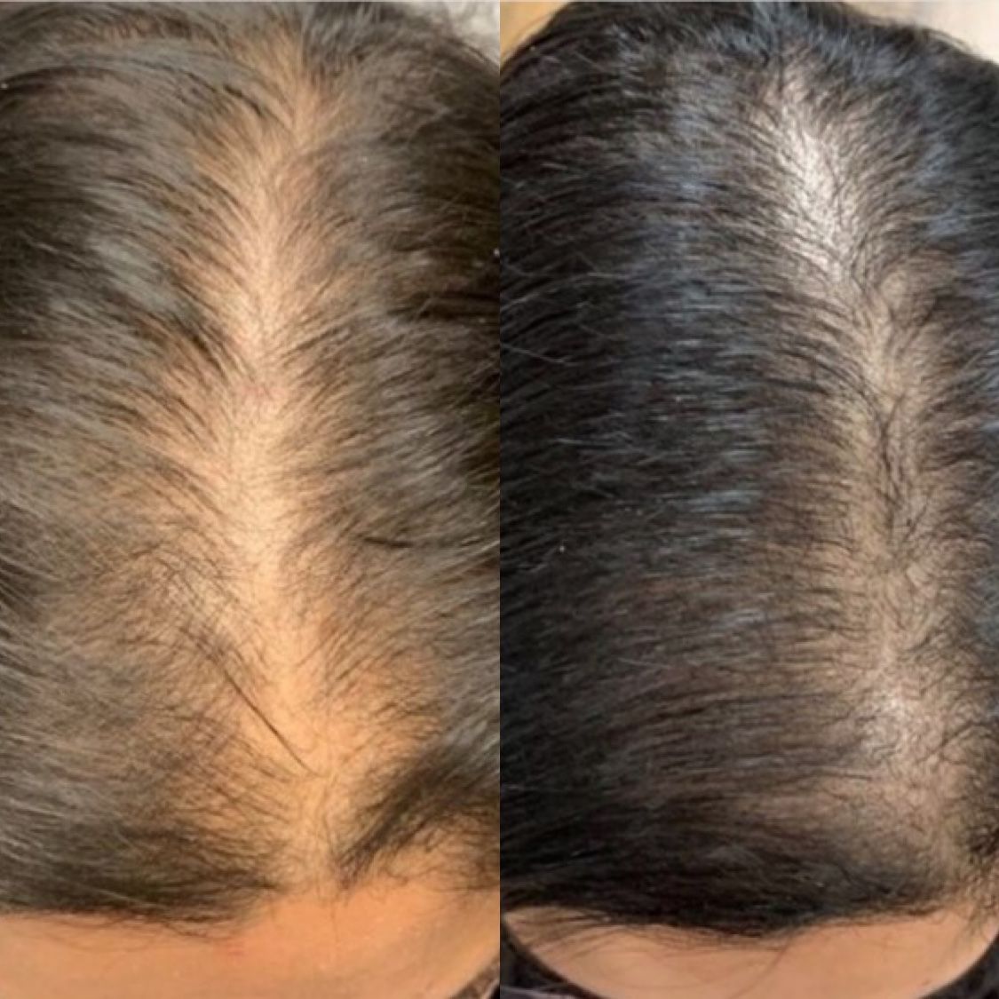 Resultado antes e depois S.O.S Crescimento – cliente 1